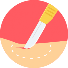 Surgery